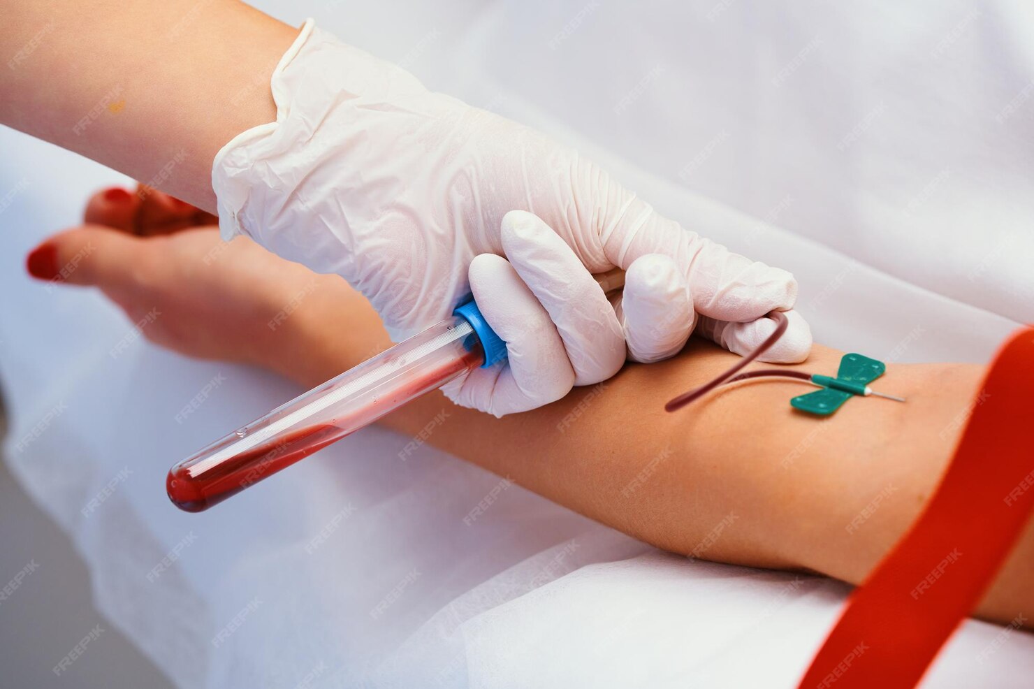 taking blood test 217333 2371