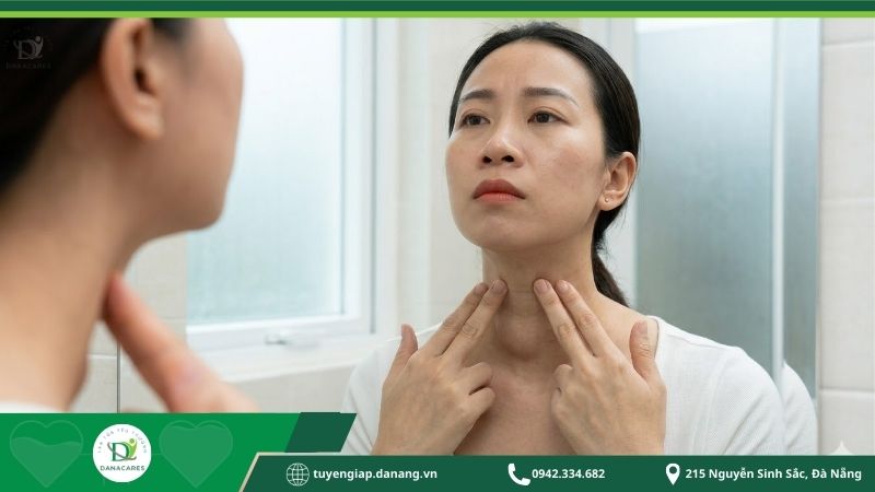 bdau-hieu-ung-thu-tuyen-giap-giai-doan-dau